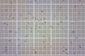 Estimating White Blood Cell Count in Blood Samples