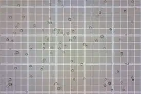Estimating White Blood Cell Count in Blood Samples