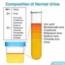 composition of urine