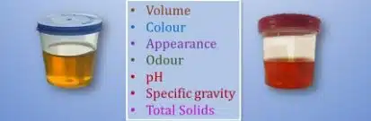 Constituents and Composition of urine
