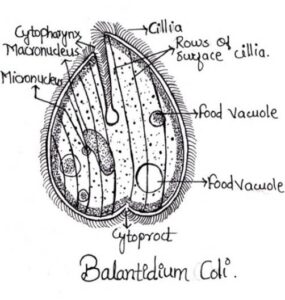 Protozoa - Balantidium-coli